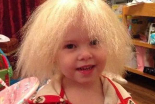 Los padres de esta niña de 9 años no peinan su cabello y aquí está la razón... Te sorprenderás cuando sepas la razón.