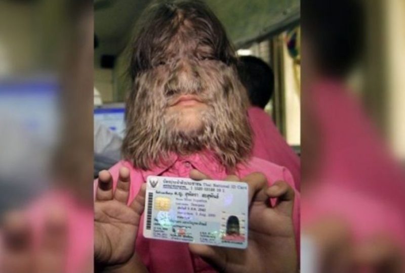 Ella es la chica más "peluda" del mundo y así es cómo luce después de cortarse el cabello...