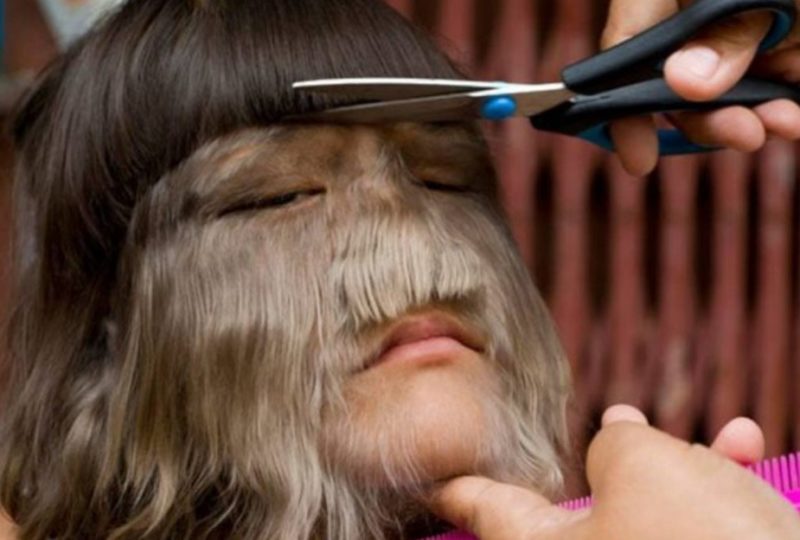 Ella es la chica más "peluda" del mundo y así es cómo luce después de cortarse el cabello...