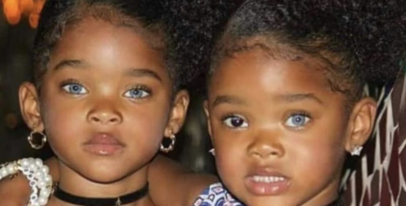 "Estas hermanas afroamericanas con ojos diferentes han crecido y lucen absolutamente hermosas."