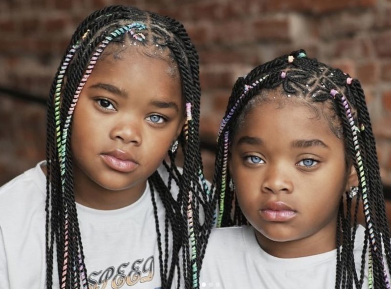 "Estas hermanas afroamericanas con ojos diferentes han crecido y lucen absolutamente hermosas."