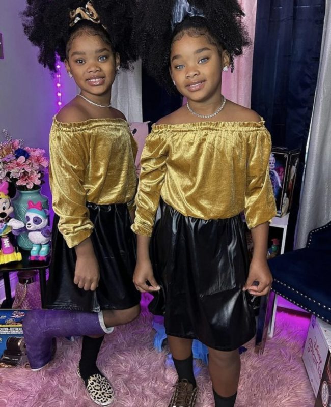 "Estas hermanas afroamericanas con ojos diferentes han crecido y lucen absolutamente hermosas."
