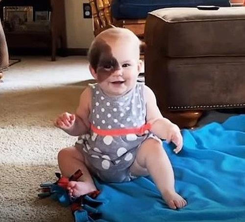 Una mamá comparte la rara marca de nacimiento de su hija para demostrar algo que derrite el corazón de todos...