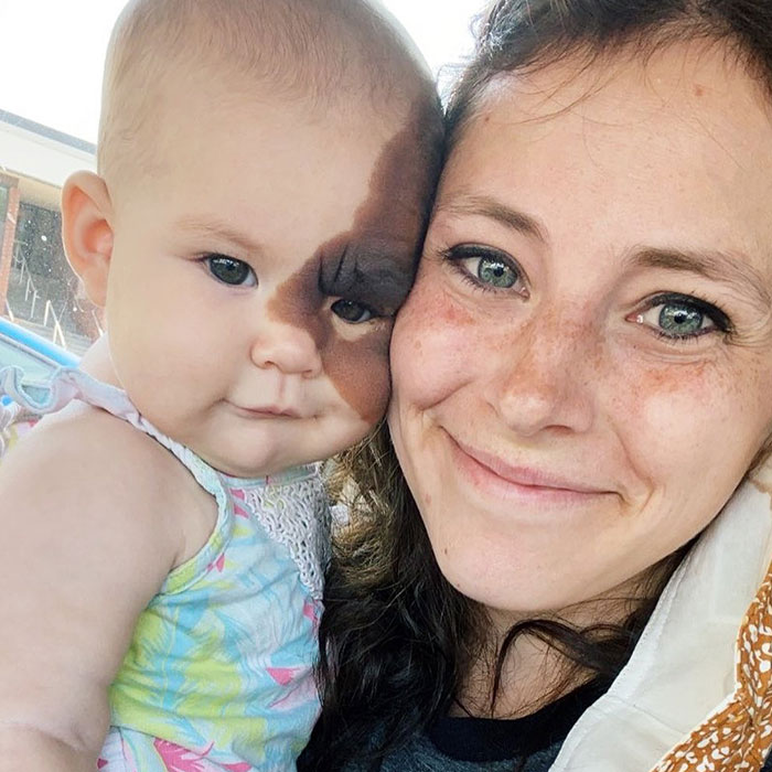Una mamá comparte la rara marca de nacimiento de su hija para demostrar algo que derrite el corazón de todos...