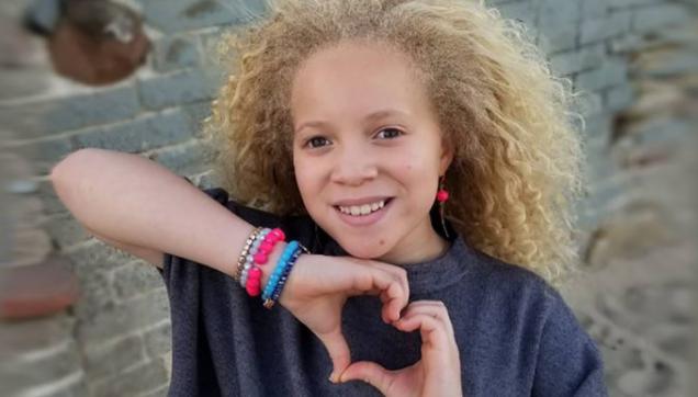 Cómo una niña albina africana ha convertido su particularidad en una virtud.