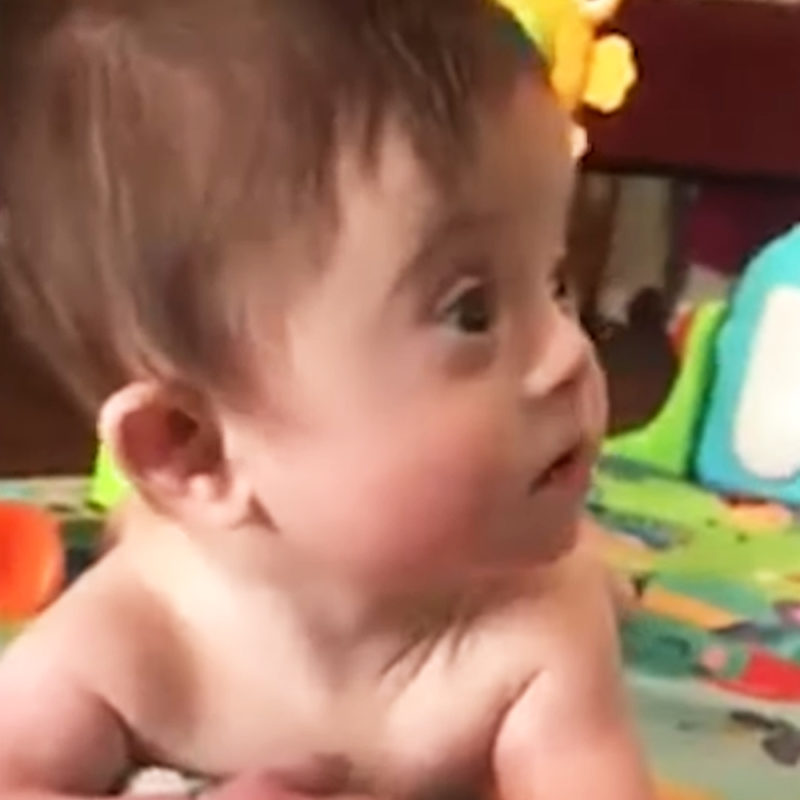 Con su hermosa sonrisa, un bebé con síndrome de Down derrite corazones.