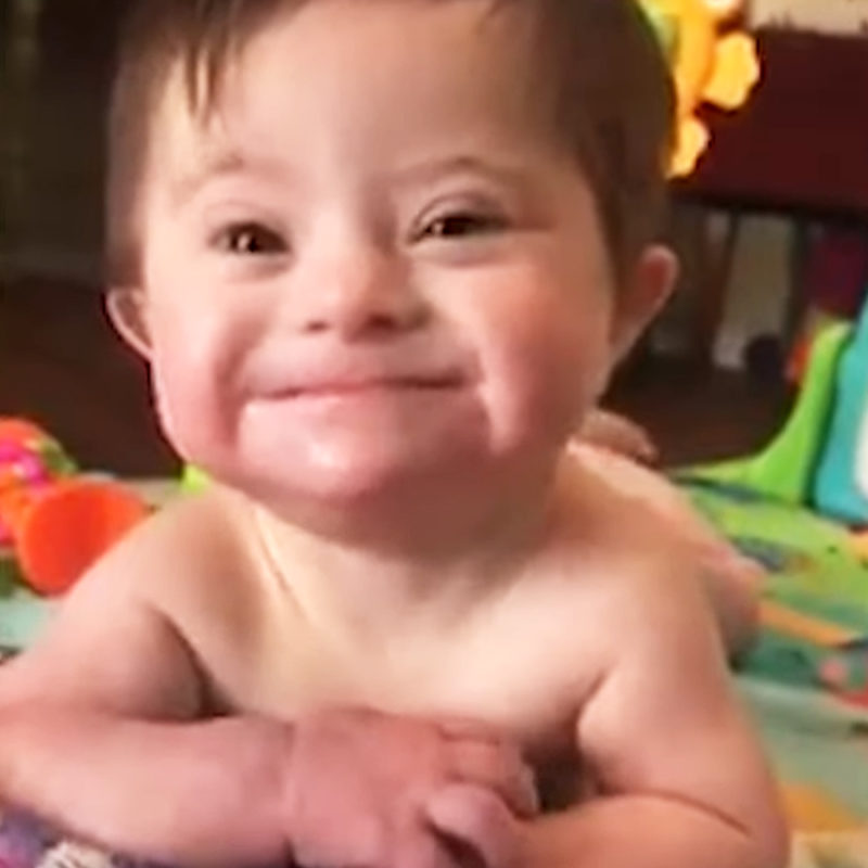 Con su hermosa sonrisa, un bebé con síndrome de Down derrite corazones.