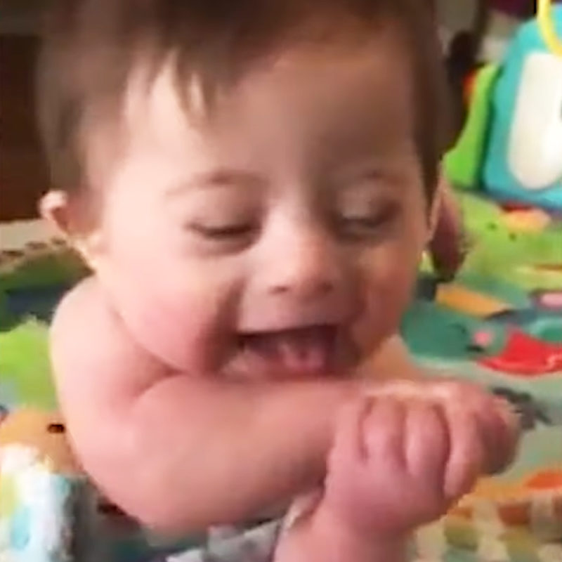 "Con su hermosa sonrisa, un bebé con síndrome de Down derrite corazones."