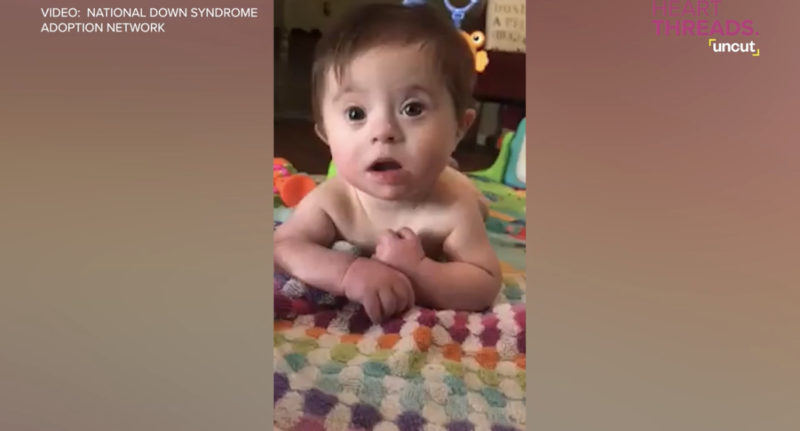 Con su hermosa sonrisa, un bebé con síndrome de Down derrite corazones.