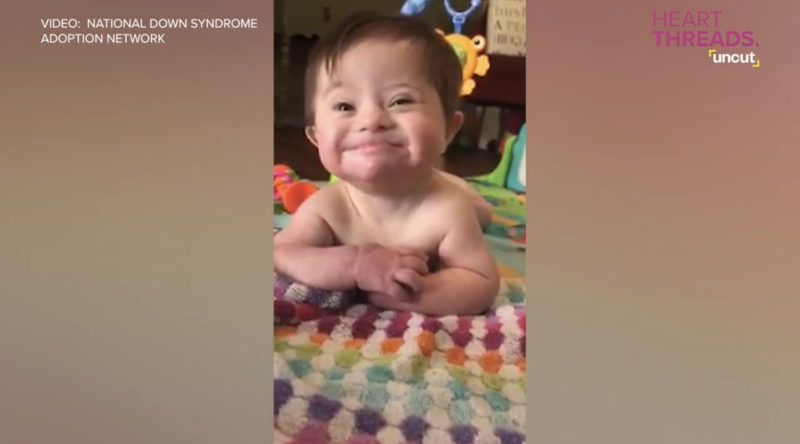 "Con su hermosa sonrisa, un bebé con síndrome de Down derrite corazones."