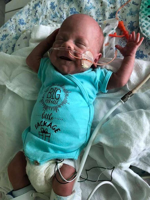 Después de una notable recuperación, un microprematuro de una libra que pasó 100 días en la UCIN regresa a casa.
