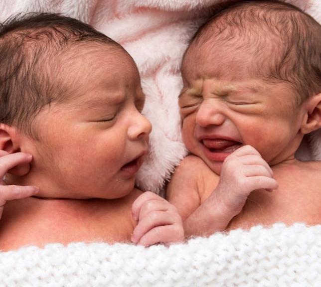 Bebés muy pequeños nacieron en la semana 22. Cómo y dónde están ahora.