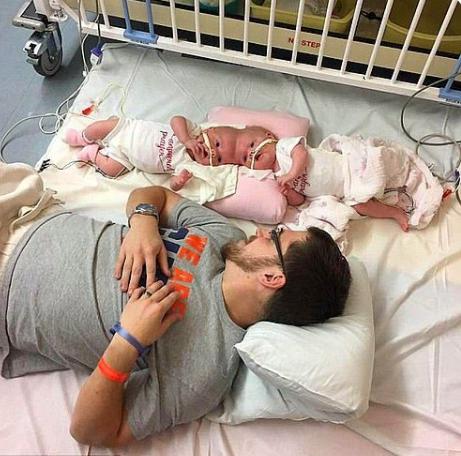 "Nobody pensó que las gemelas lo lograrían. Cómo es para las niñas después de la operación más difícil de todas."