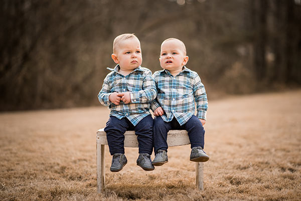 Estos gemelos siameses fueron separados cuando eran bebés, y aquí está cómo lucen a los 7 años de edad...