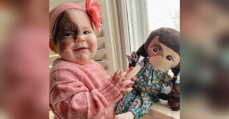 "Ella puede hacer cualquier cosa." Mamá comparte la belleza de la marca de nacimiento de su hija con el mundo.