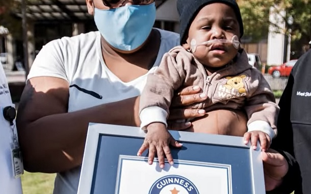 El bebé más joven que sobrevivió, superó todas las probabilidades y estableció un récord Guinness.
