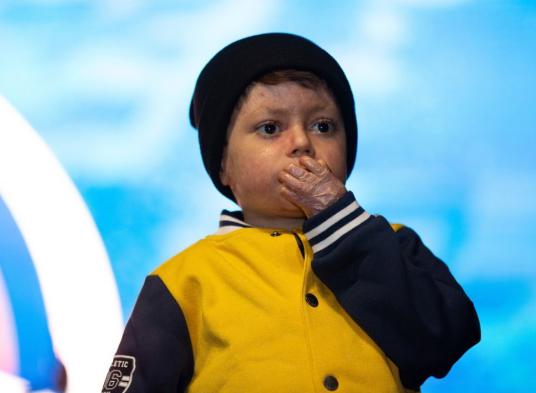 Después de 16 días en coma, las emociones de alegría inundaron a madre e hijo en un conmovedor momento de reunión.