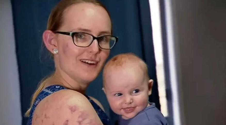 El heroico acto de una madre salva a su pequeña hija de graves contusiones durante una tormenta en Australia.