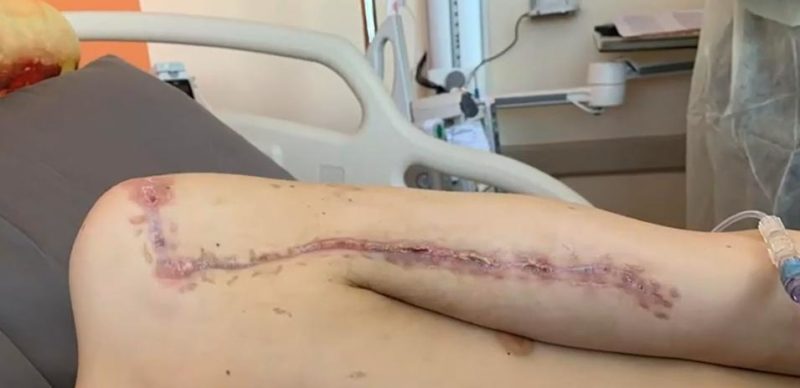 Una historia única, cicatrices compartidas: un padre y un hijo se sientan bajo la aguja del tatuador en un conmovedor gesto de respeto mutuo.