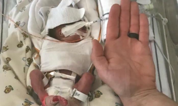 Exhaustos padres en la unidad de cuidados intensivos neonatales reciben cuidado y apoyo de la propietaria de un salón de belleza que pasó por experiencias similares."