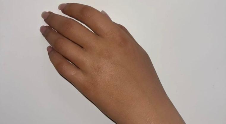 "La chica que nació sin un brazo hizo realidad su sueño. Ahora tiene una prótesis realista con pecas dibujadas y uñas acrílicas."