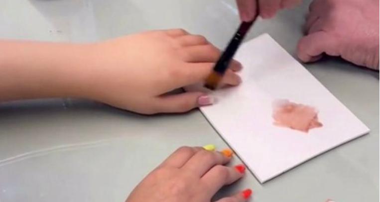 "La chica que nació sin un brazo hizo realidad su sueño. Ahora tiene una prótesis realista con pecas dibujadas y uñas acrílicas."