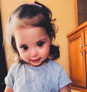 "Esta chica tiene enormes ojos debido a un defecto genético que los hace parecer los ojos de un extraterrestre.