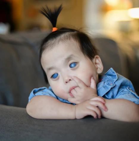 La vida de una familia estadounidense cambió para siempre después de adoptar a una niña con unos increíbles ojos azules que habían sido abandonada.