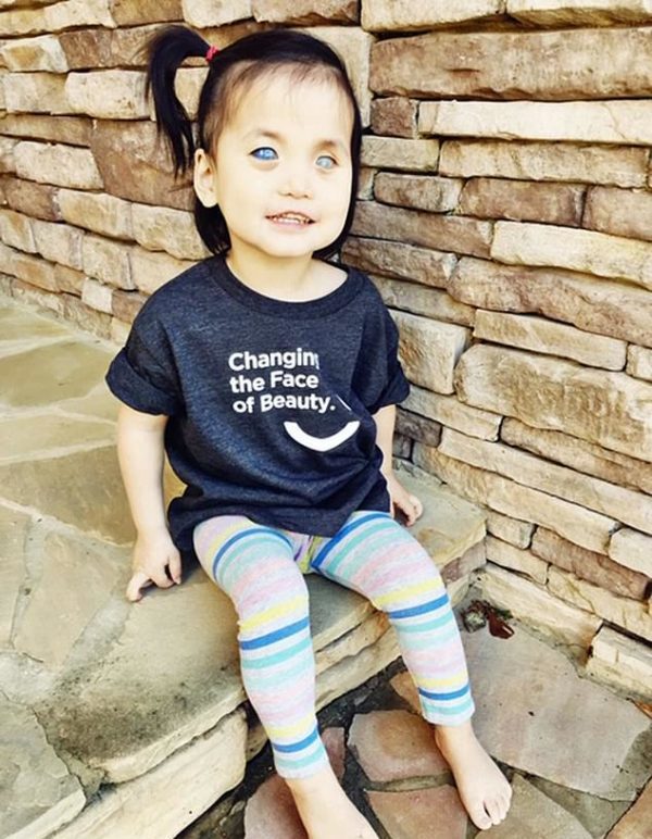 La vida de una familia estadounidense cambió para siempre después de adoptar a una niña con unos increíbles ojos azules que habían sido abandonada.