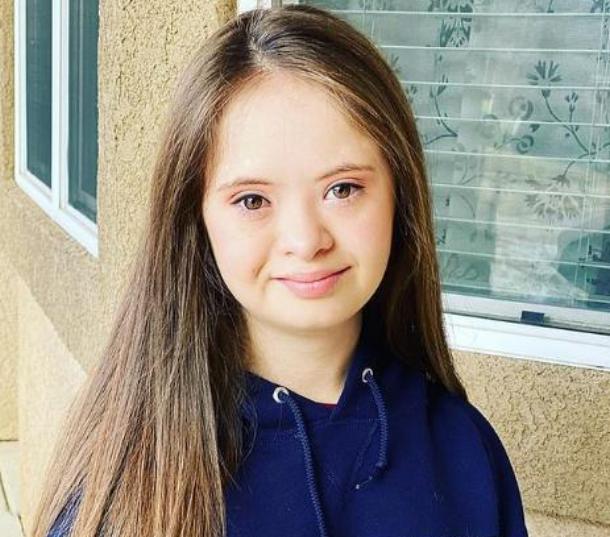 La mujer no siguió el consejo de los médicos, pero a pesar de eso, su hija creció en una verdadera belleza.
