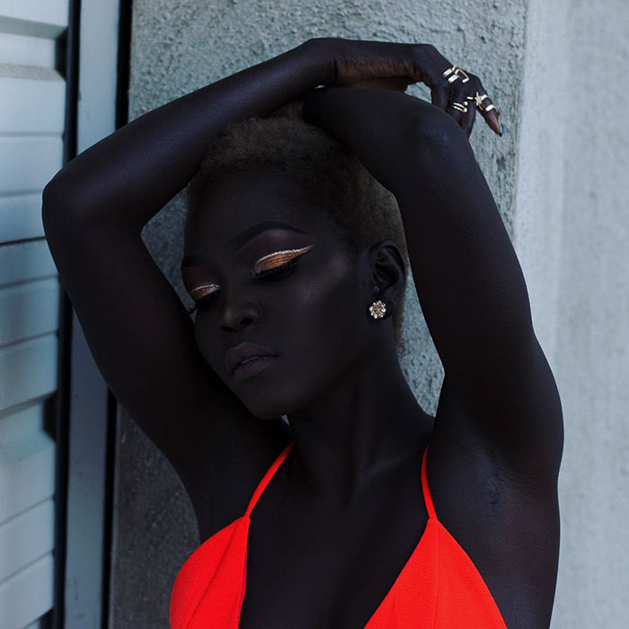 La chica era objeto de burlas debido a su piel, pero gracias a su color inusual, se convirtió en modelo.