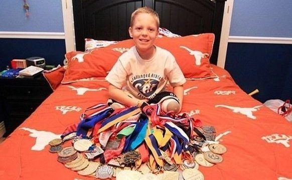 Fuera de la norma común: Un raro padecimiento limitó al niño, pero aún así es feliz.