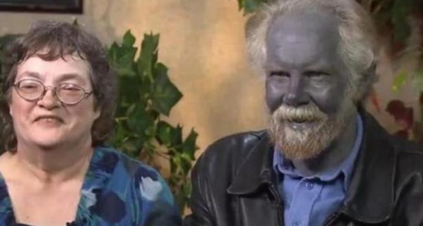 Los Fugate Azules. La interesante historia de una familia real con piel azul.