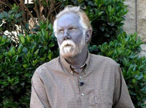 Los Fugate Azules. La interesante historia de una familia real con piel azul.