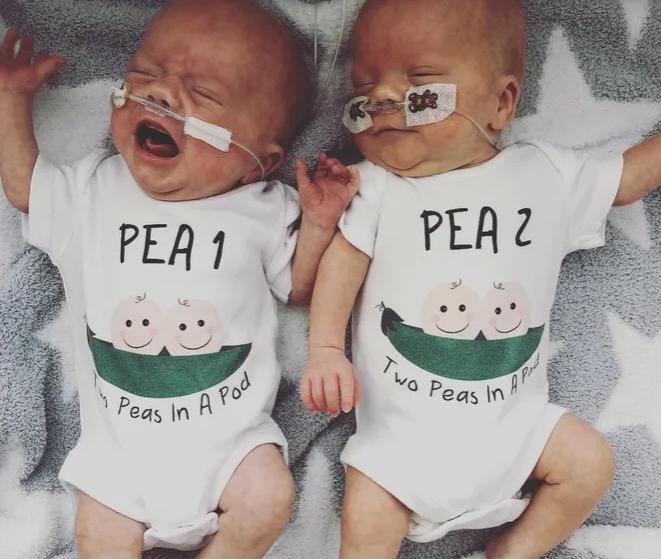 Gemelos nacidos prematuramente con dos días de diferencia: Cómo es posible.
