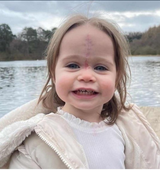 "Imágenes de una niña con un lunar desde su nacimiento hasta el proceso de su eliminación: fotografías de su desarrollo."