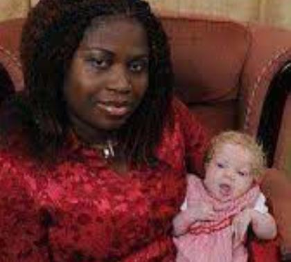 Una niña nacida en una familia africana y con piel blanca, ¿cómo se adapta y lleva su vida?