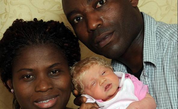 Una niña nacida en una familia africana y con piel blanca, ¿cómo se adapta y lleva su vida?