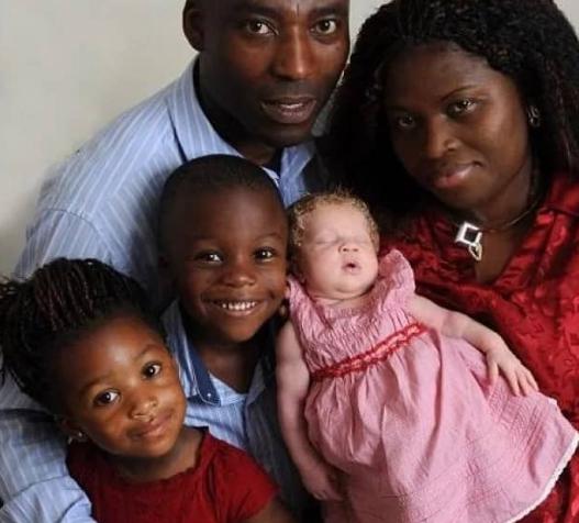 Una niña nacida en una familia africana y con piel blanca, ¿cómo se adapta y lleva su vida?