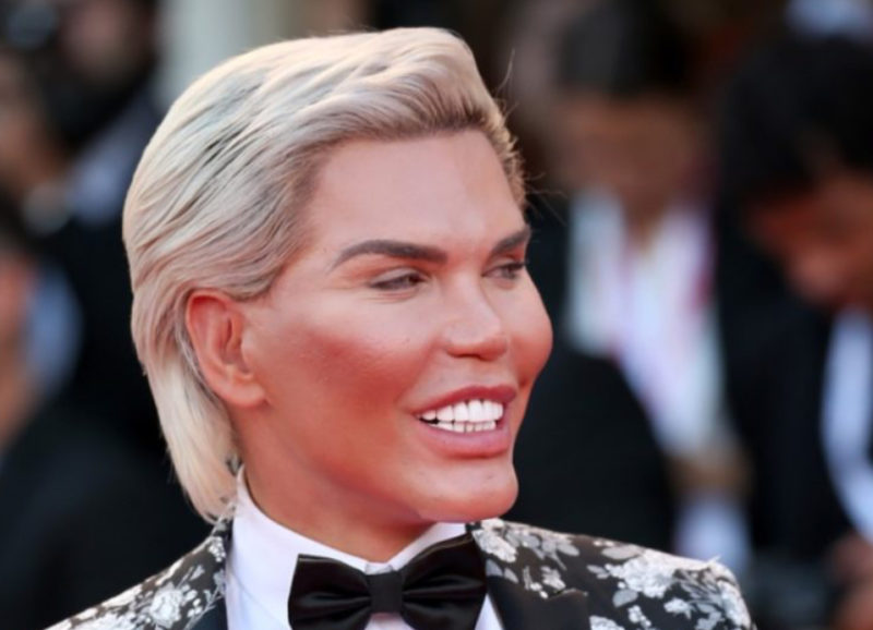 Había una vez un chico guapo: mira cómo era Ken Rodrigo Alves antes de la cirugía plástica.