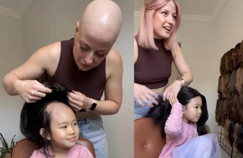 Alegría incontenible: Observa la reacción de una niña de 4 años ante su primera peluca mientras enfrenta la alopecia areata | VIDEO