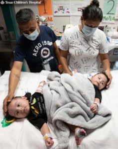 Padres y equipo médico rezan por gemelos unidos momentos antes de una cirugía de 17 horas, expresan gratitud mientras los gemelos regresan a casa sanos.