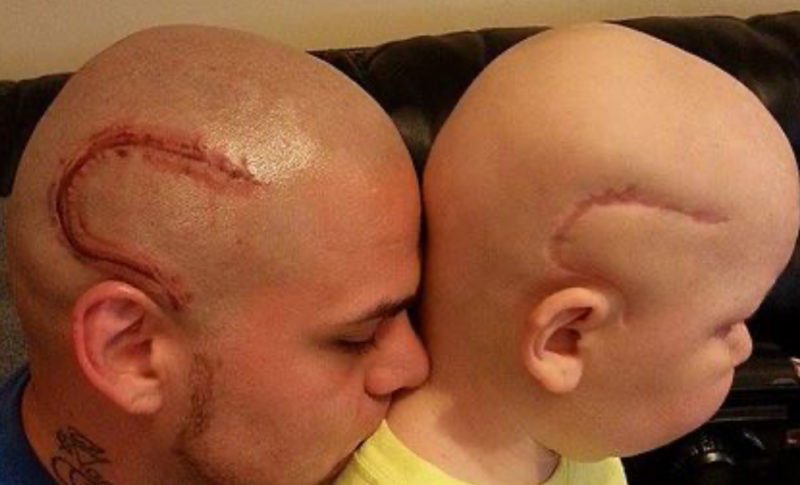 Para que su hijo no se sintiera solo, el padre dio este paso maravilloso.