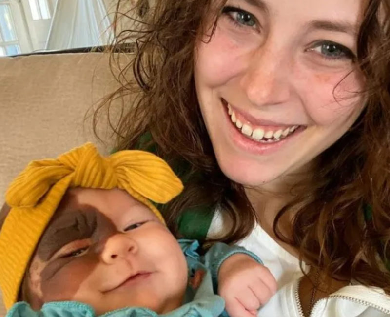 "Ella puede hacer cualquier cosa". Mamá comparte la belleza de la marca de nacimiento de su hija con el mundo.