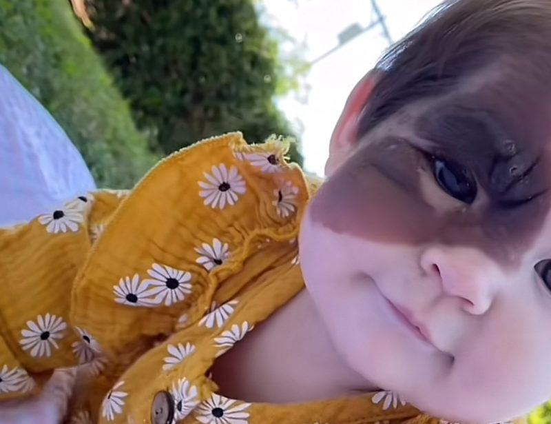 "Ella puede hacer cualquier cosa". Mamá comparte la belleza de la marca de nacimiento de su hija con el mundo.