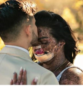 Mujer enfrenta los estándares de belleza y encuentra la felicidad en un lugar inesperado.