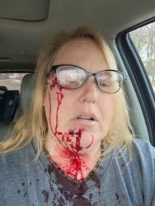 Abuela intrépida pone en su sitio a un Pitbull, paga el precio mientras protege a sus nietos pequeños. Echa un vistazo a su advertencia a todos los padres.