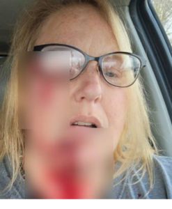Abuela intrépida pone en su sitio a un Pitbull, paga el precio mientras protege a sus nietos pequeños. Echa un vistazo a su advertencia a todos los padres.