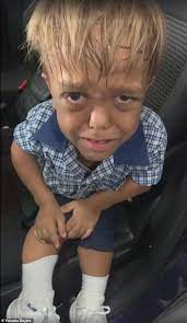 Siendo maltratado en la escuela debido a su enanismo, el niño sufrió mucho... Pero observa dónde está ahora.