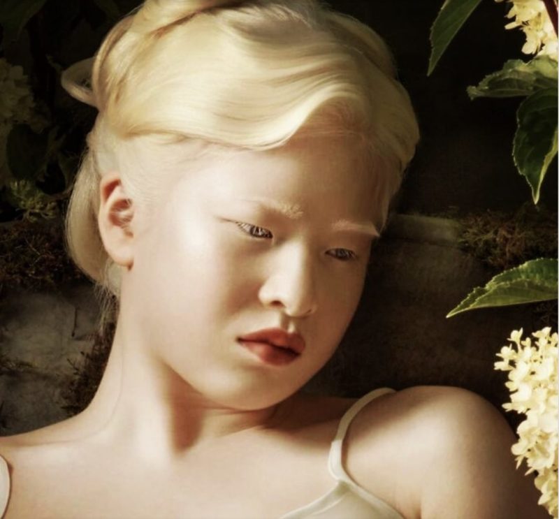 Cómo la chica única abandonada se convirtió en una modelo de Vogue y lo que desea transmitir...